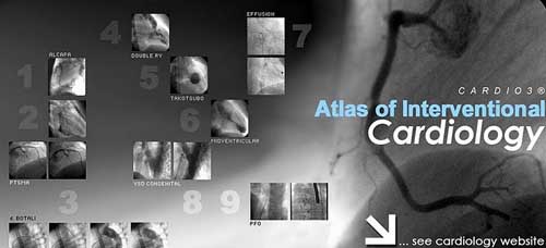 CARDIO3® INVASIVE v1.1 CARDIO3® INVASIVE