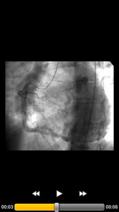 اسکرینشات 1 از محیط برنامه CARDIO3® INVASIVE v1.1 برای اندروید